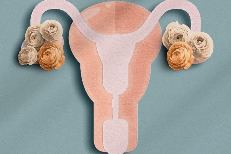 Polycystic ovary syndrome