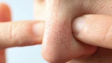 الرؤوس السوداء