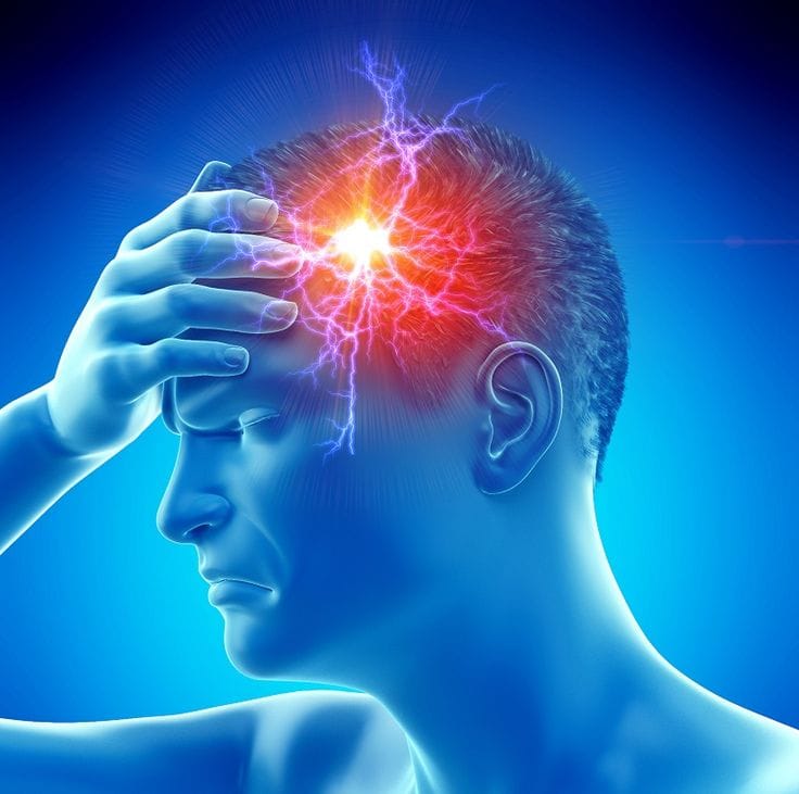 Migraine