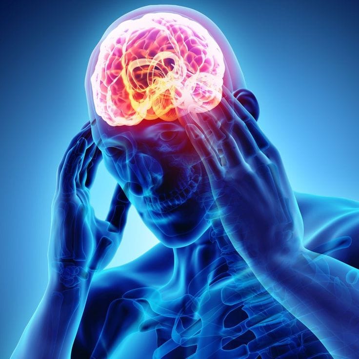 Migraine
